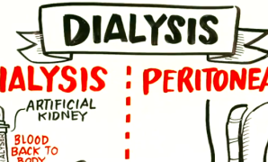 Failing Kidneys and Dialysis